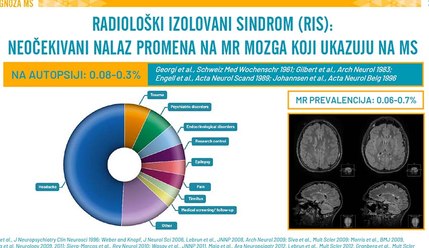 Dijagnostika, diferencijalna dijagnostika i klinička prezentacija Multiple skleroze